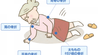 糖尿病と骨粗鬆症との関係？